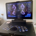 Новое оборудование поможет выявлять ишемическую болезнь сердца на ранней стадии